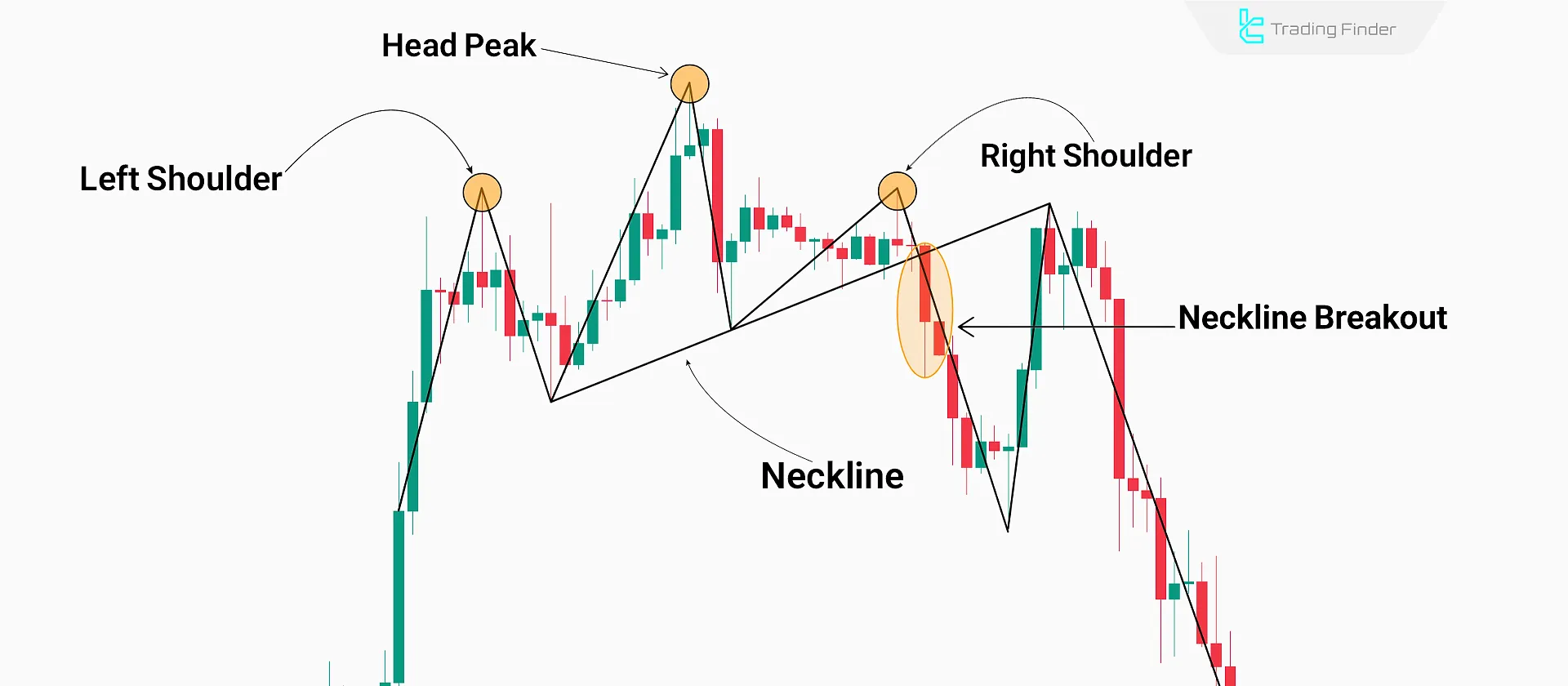 Components of the head and shoulders pattern